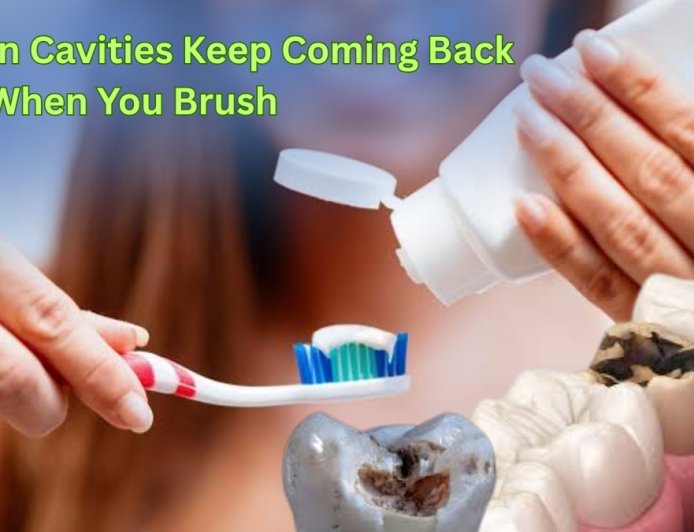 The Real Reason Cavities Keep Coming Back Even When You Brush